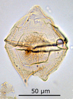 Palaeoperidinium pyrophorum
